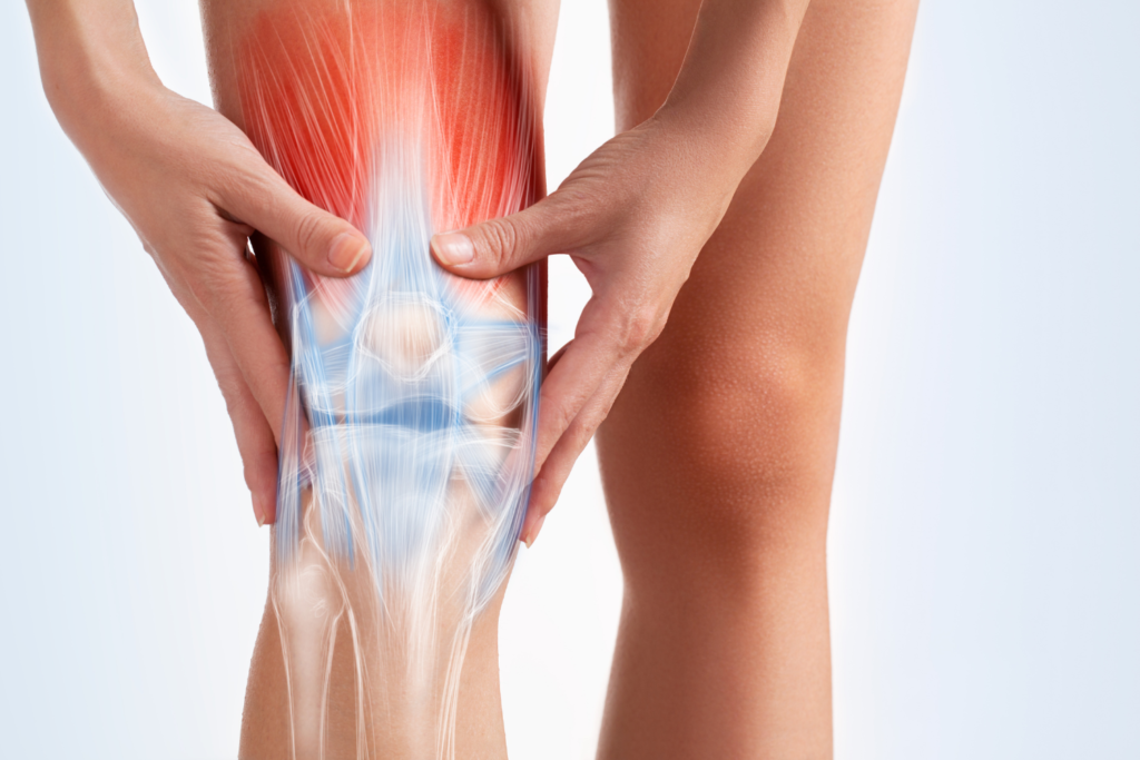 Knee Replacement Surgery