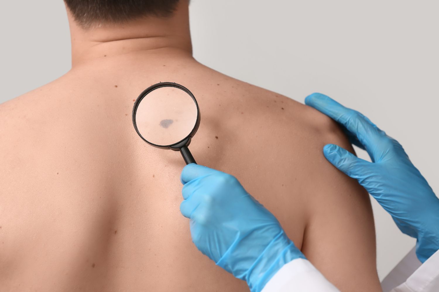 best dermatologist in delhi
