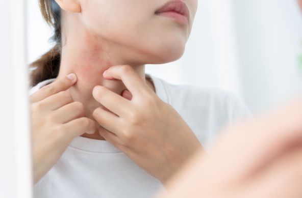 skin problems in delhi
