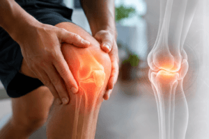 Knee pain causes